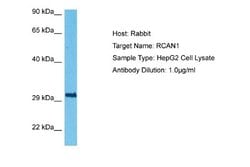 RCAN1 Antibody, Novus Biologicals 100 &mu;L | Buy Online | Novus Biologicals | Fisher Scientific